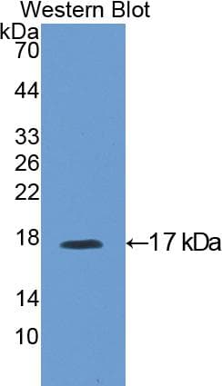 IGFBP3 Antibody (aa137-274)