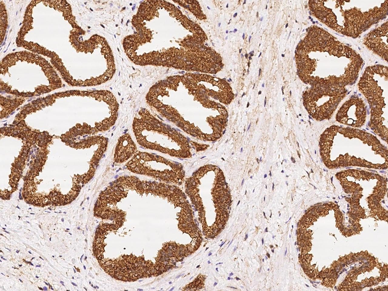 ENDOD1 Antibody