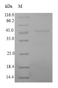 Rat NCAM / CD56 Protein (Recombinant 10His, N-terminus + Myc, C-terminus)