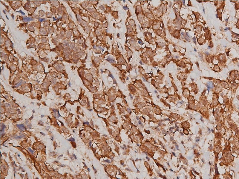 KRT8 / CK8 / Cytokeratin 8 Antibody (phospho-Ser432)