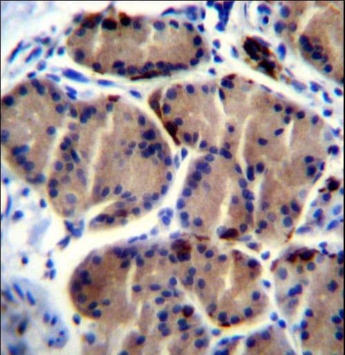 LIPC / Hepatic Lipase Antibody (aa310-338)
