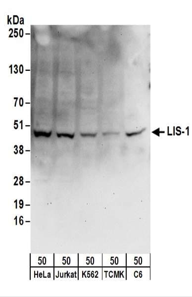 Polyclonal Rabbit anti-Human PAFAH1B1 / LIS1 Antibody (aa1-50, WB)