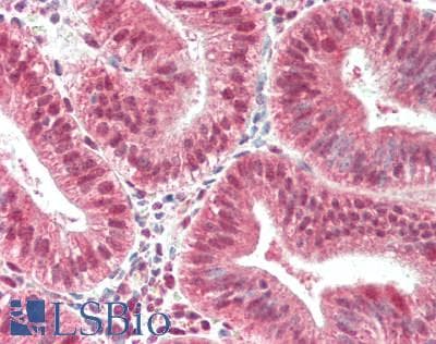Polyclonal Rabbit anti-Human PIK3C3 / VPS34 Antibody (Ser851, IHC, WB)