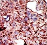 Polyclonal Rabbit anti-Human HK1 / Hexokinase 1 Antibody (aa705-734, IHC, WB)