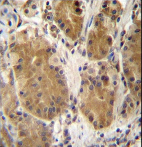 Polyclonal Rabbit anti-Human PCDHB5 Antibody (aa278-307, IHC, WB)