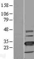 TMEM41A Protein (Over-Expression Lysate Myc-DDK (Flag))
