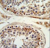 Polyclonal Rabbit anti-Human ITGB3 / Integrin Beta 3 / CD61 Antibody (aa734-760, IHC, WB)