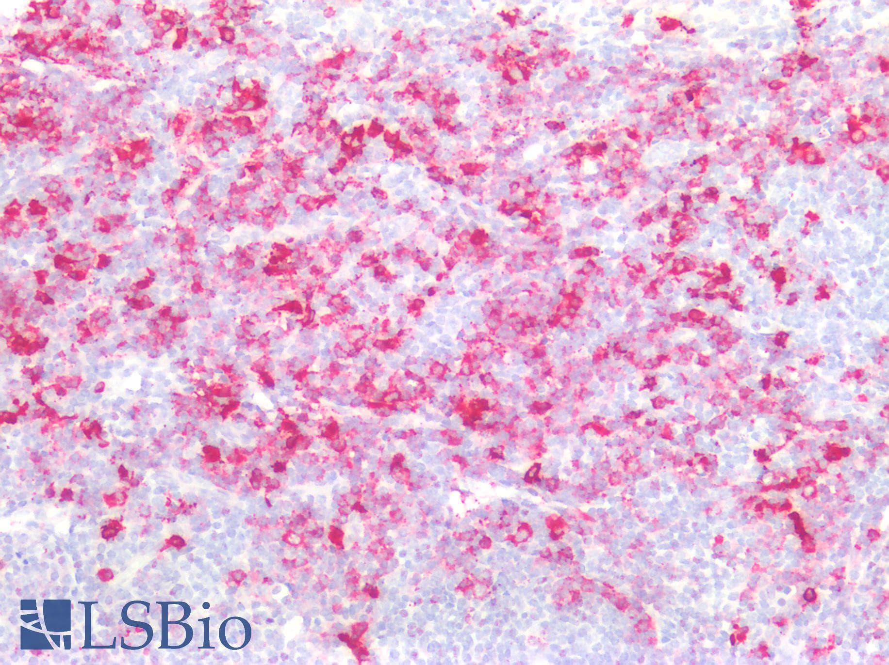Polyclonal Rabbit anti-Human REXO2 Antibody (aa41-213, IHC, WB)