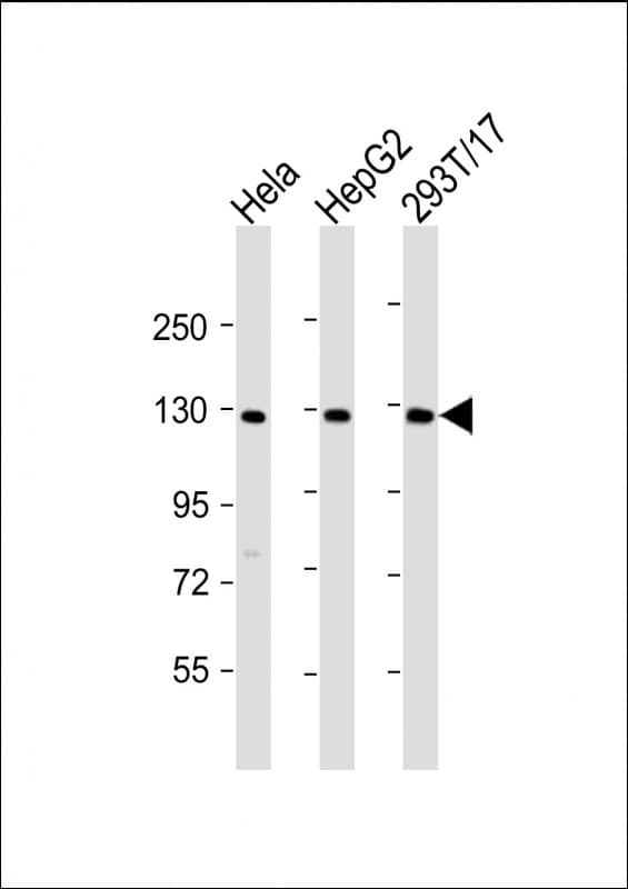 Polyclonal Rabbit anti-Human LRIG3 Antibody (N-Terminus, WB)