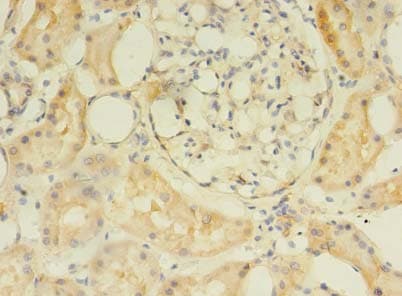Polyclonal Rabbit anti-Human C2orf69 Antibody (IHC)