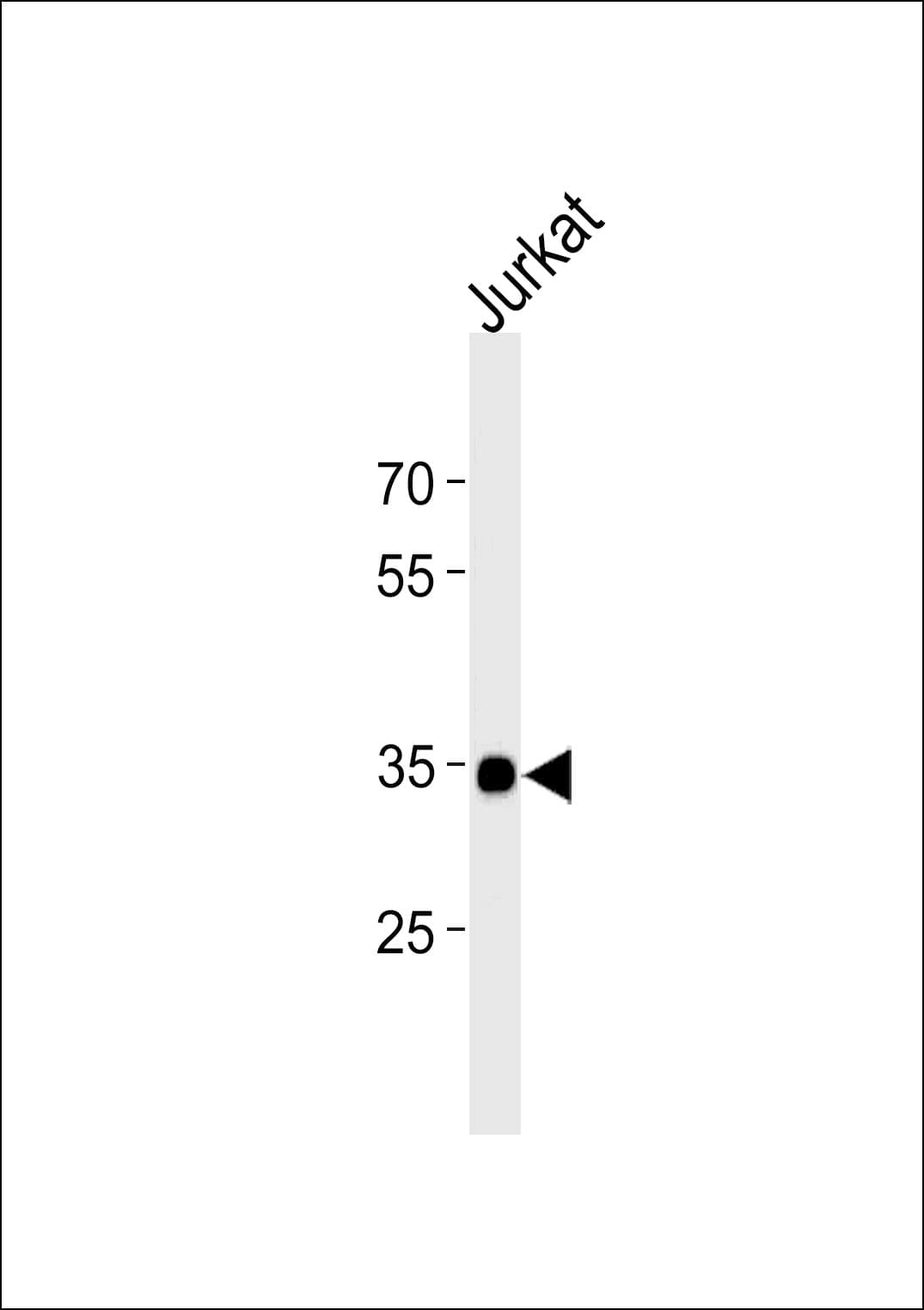 Polyclonal Rabbit anti-Human SOX18 Antibody (aa59-88, IF, WB)