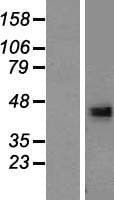 DHRS13 Protein (Over-Expression Lysate Myc-DDK (Flag))