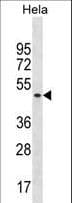 SF3B4 Antibody (aa158-187)