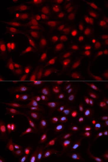 APEX1 / APE1 Antibody
