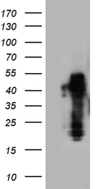 Monoclonal Mouse anti-Human ZRANB2 / ZNF265 Antibody (clone OTI2E3, aa95-320, IHC, WB)