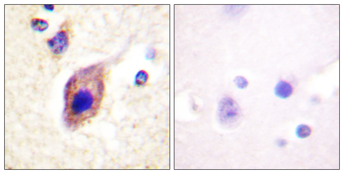 PLCG2 / PLC Gamma 2 Antibody (aa1186-1235)
