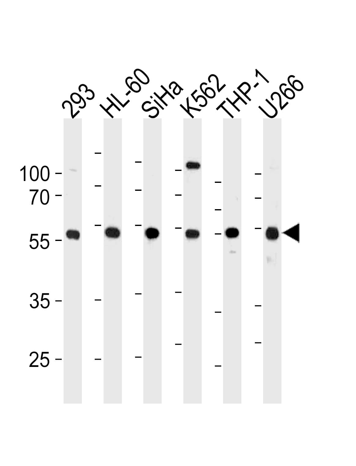 Polyclonal Rabbit anti-Human YY1 Antibody (aa74-104, IHC, WB)