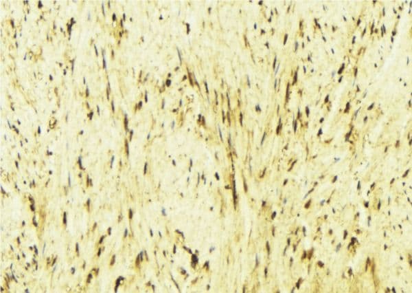 CAMK2B / CaMKII Beta Antibody