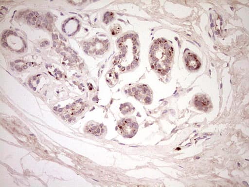 Monoclonal Mouse anti-Human CTGF Antibody (clone OTI2C9, aa27-349, IHC)