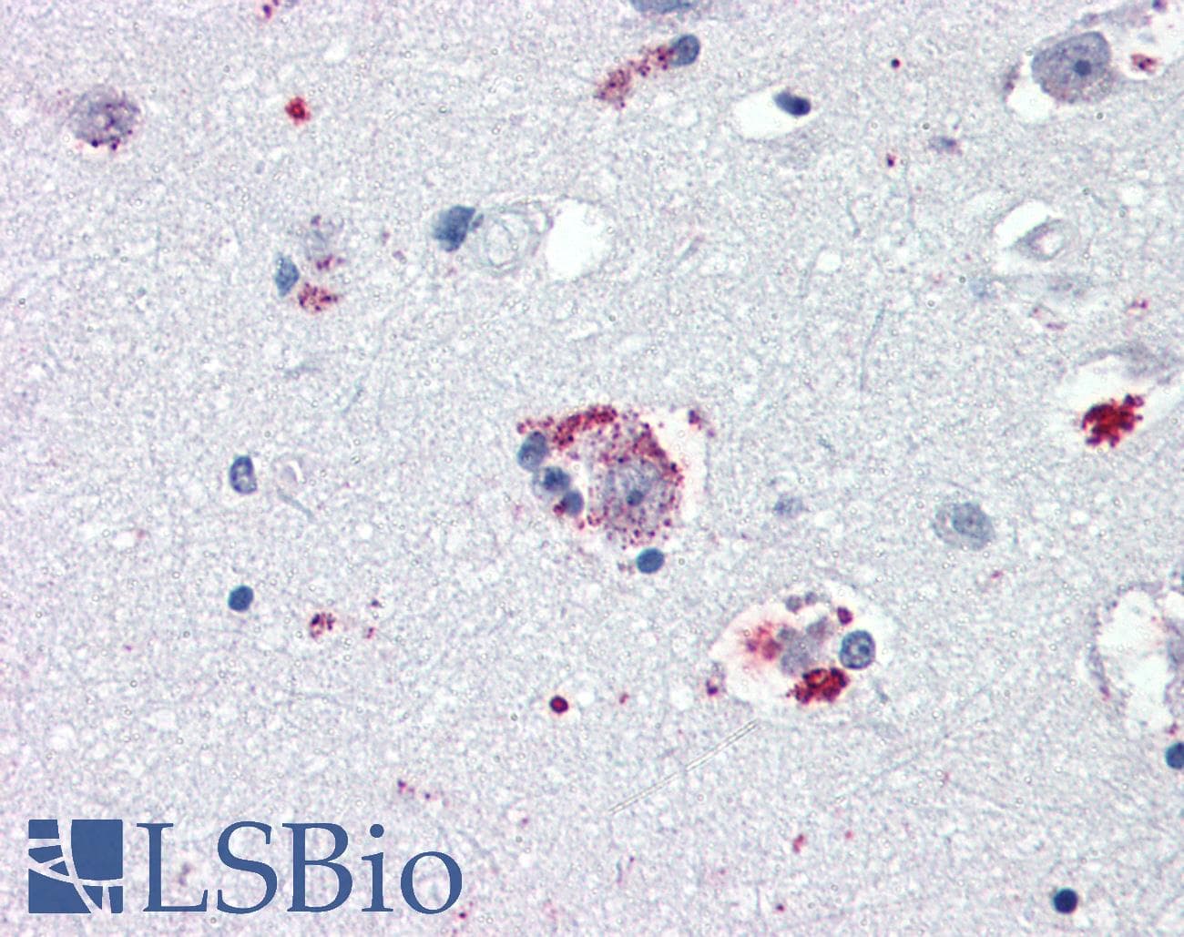 IHC-plus™ TAAR8 Antibody (N-Terminus)