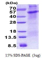 Human CD30 Protein (Recombinant His)