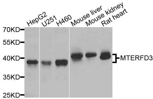 Polyclonal Rabbit anti-Human MTERF2 / MTERFD3 Antibody (IHC, WB)