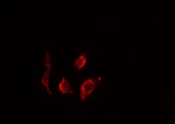 PPP2R2B Antibody