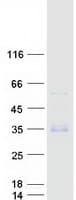 Human WFDC3 Protein (Recombinant Myc-DDK (Flag))