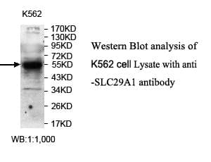 SLC29A1 / ENT1 Antibody (N-Terminus)