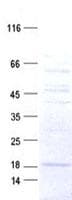 Human ARMS2 Protein (Recombinant Myc-DDK (Flag), C-terminus)