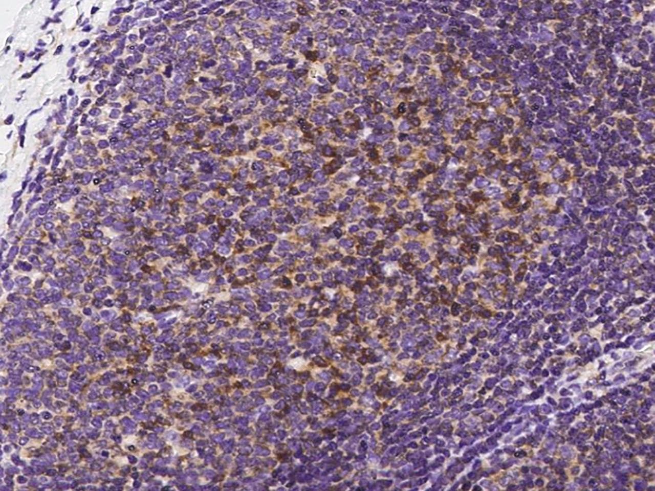 PDCD1 / CD279 / PD-1 Antibody