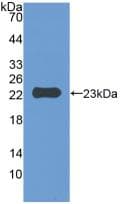 Mouse CD47 Protein (Recombinant His, N-Terminal)