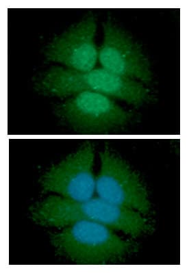 UGDH / UDPGDH Antibody (clone AT2G11)