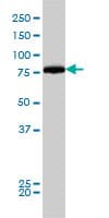 Monoclonal Mouse anti-Human DNM1L / DRP1 Antibody (clone 3B5, IHC, WB)