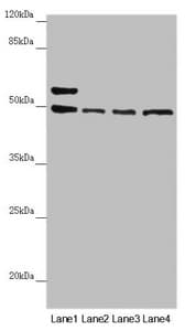 Polyclonal Rabbit anti-Human AP1M1 Antibody (IHC, WB)