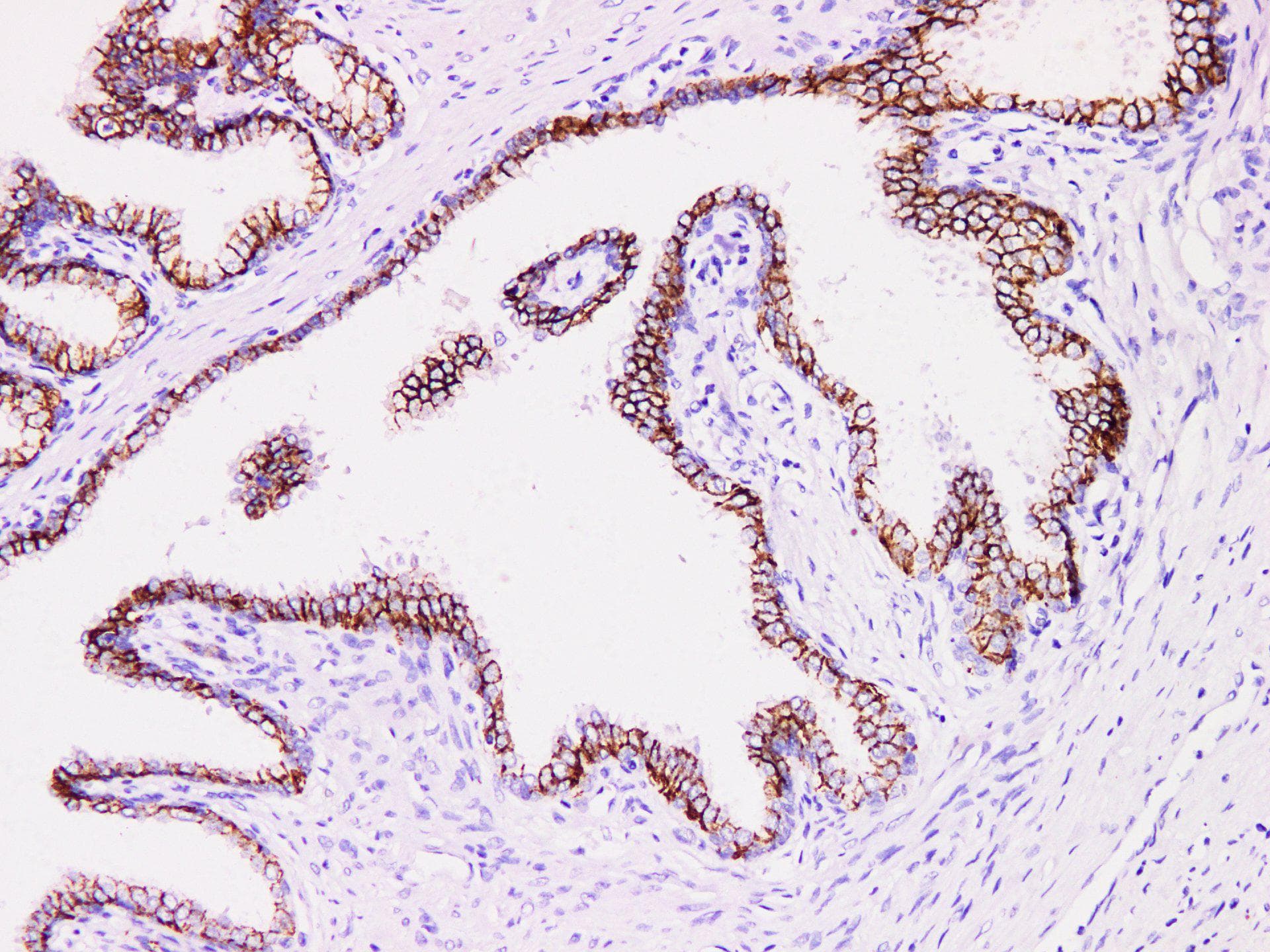 ACPP / PAP Antibody