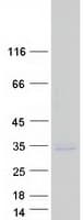 Human TMEPAI / PMEPA1 Protein (Recombinant Myc-DDK (Flag))