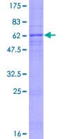Human LPPR2 Protein (Recombinant GST)