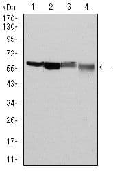 Monoclonal Mouse anti-Human G6PD Antibody (clone 5E+12, IHC, WB)