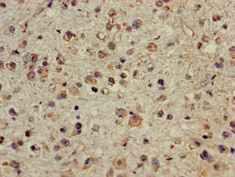Polyclonal Rabbit anti-Human CDYL Antibody (IHC)