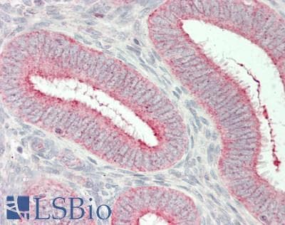 IHC-plus™ Polyclonal Rabbit anti-Human ATAD3A Antibody (aa1-240, IHC, WB)