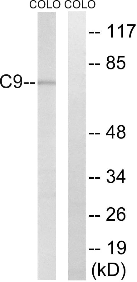 IHC-plus™ Complement C9 Antibody (aa181-230)
