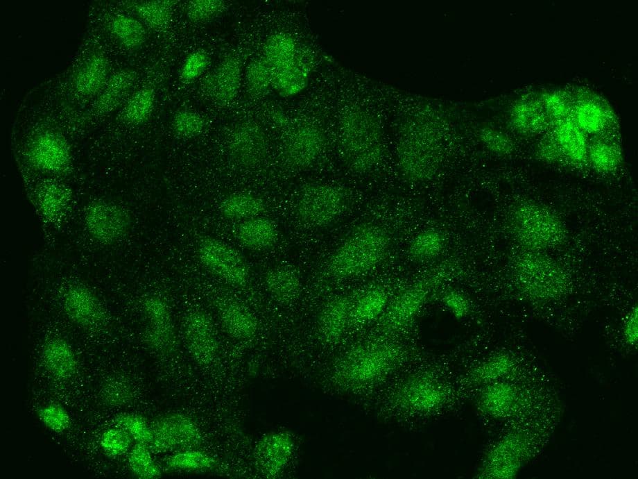 Polyclonal Rabbit anti-Human NFE2L3 Antibody (IF)