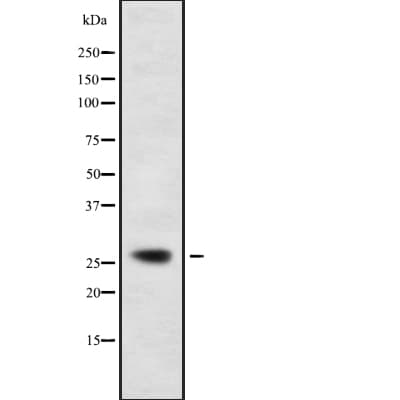 Polyclonal Rabbit anti-Human CD302 Antibody (IHC, IF, WB)