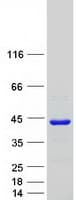 Human PDCL Protein (Recombinant Myc-DDK (Flag))