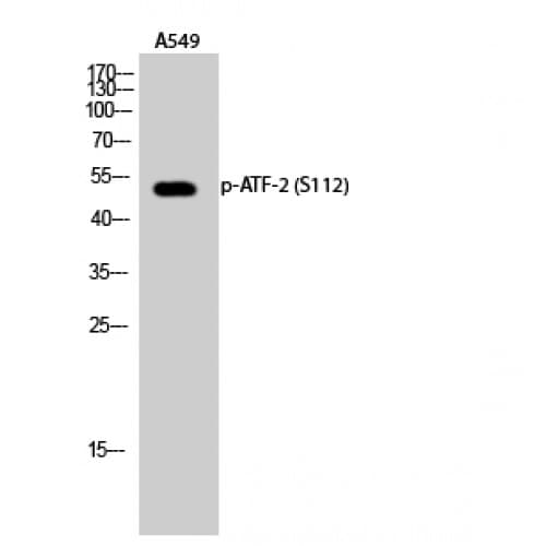 ATF2 Antibody (50-130 aa)