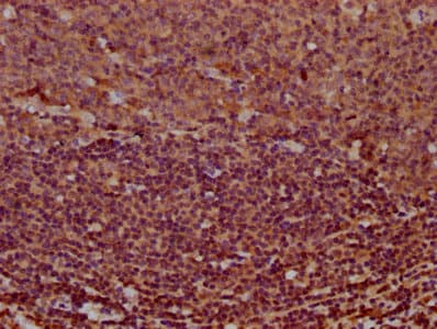 Polyclonal Rabbit anti-Human MS4A2 / FCERI Antibody (IHC, IF)