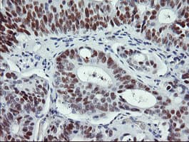 Monoclonal Mouse anti-Human TP53 / p53 Antibody (clone OTI1E1, IHC, WB)