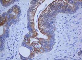 KRT20 / CK20 / Cytokeratin 20 Antibody (aa1-266, clone OTI4A2, Carrier-free)