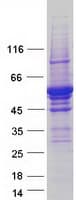 Human TPH2 Protein (Recombinant Myc-DDK (Flag))